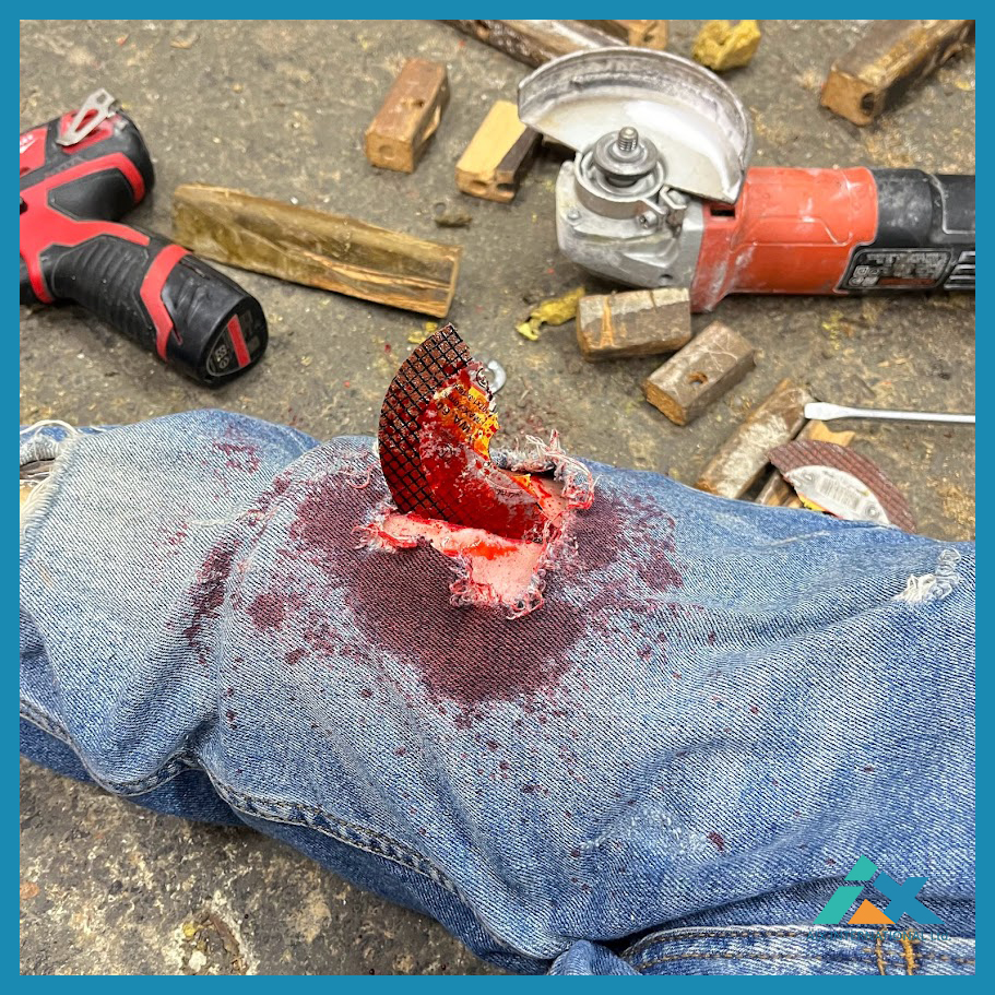 Arm Bleeding Control