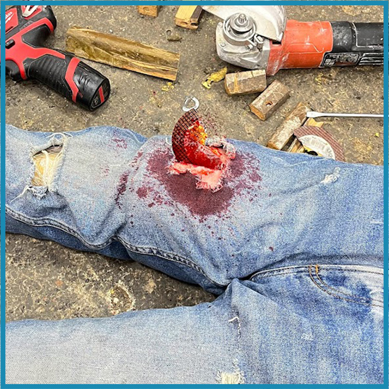 Arm Bleeding Control
